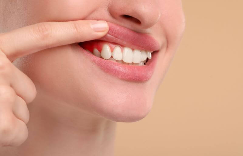 Cirugía periodontal realizada por especialista en clínica odontológica