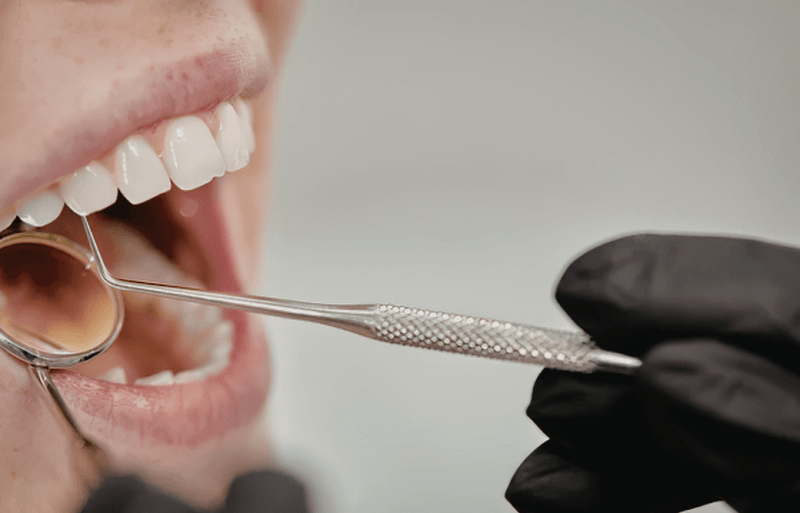 Diagnóstico periodontal en Cali evaluación de encías y salud bucal
