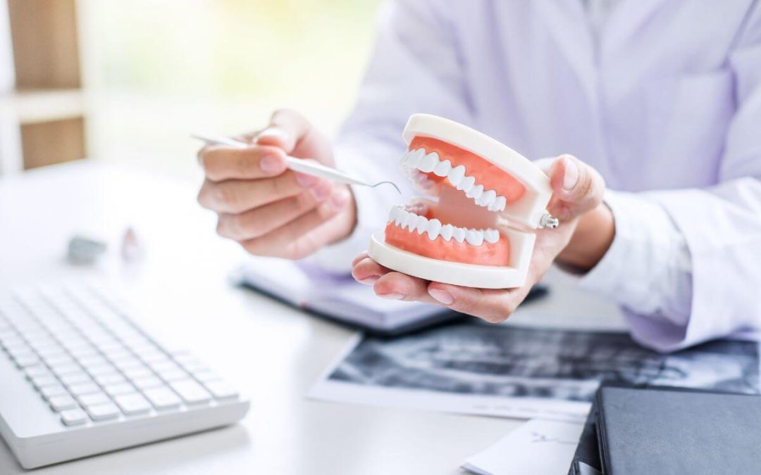 Limpieza dental profesional